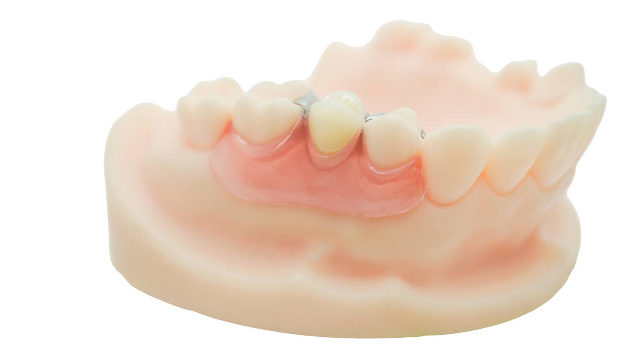 春日井市のコンティ―ス