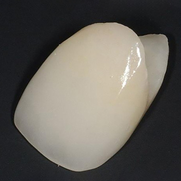 春日井市のジルコニア