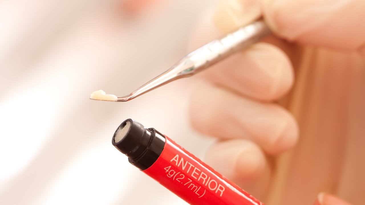 春日井市のダイレクトボンディング