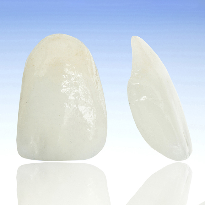 春日井市のラミネートベニア