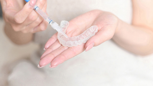 春日井市のホワイトニング