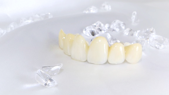 春日井市のジルコニア