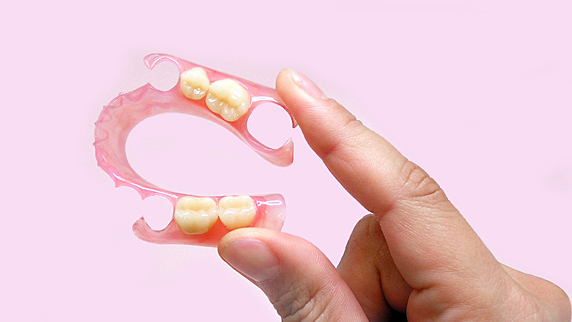 春日井市のノンクラスプデンチャー（スマイルデンチャー） 