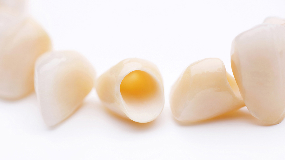 春日井市のジルコニア