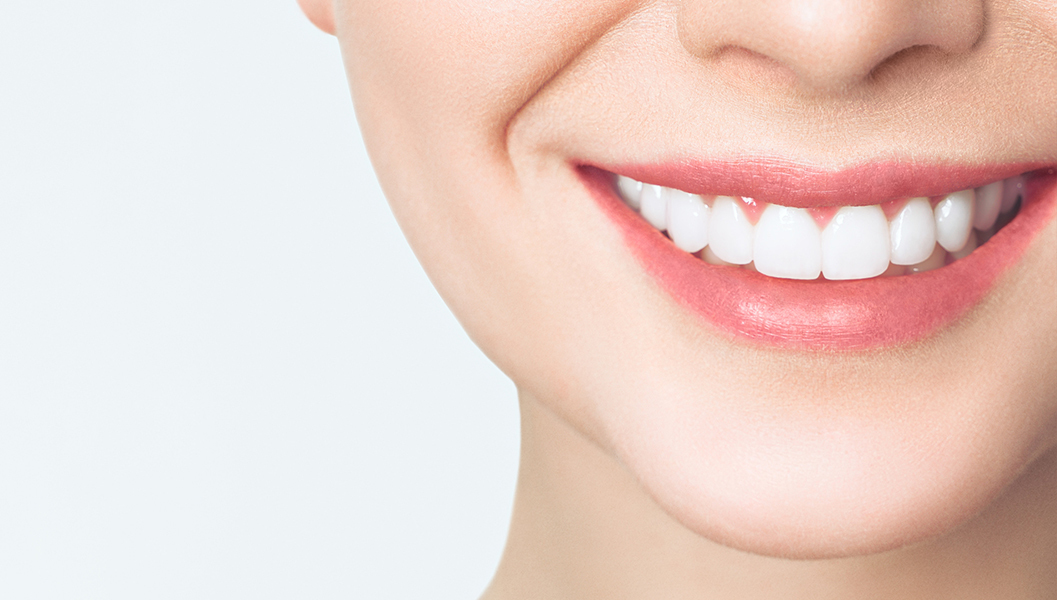 春日井市の審美歯科